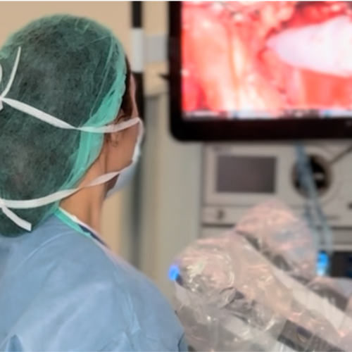 Uróloga manejando el robot Da Vinci realizando una cirugía robótica urológica