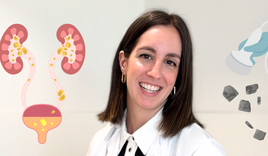 Dra. Sanz con imagen de piedras en las vías urinarias
